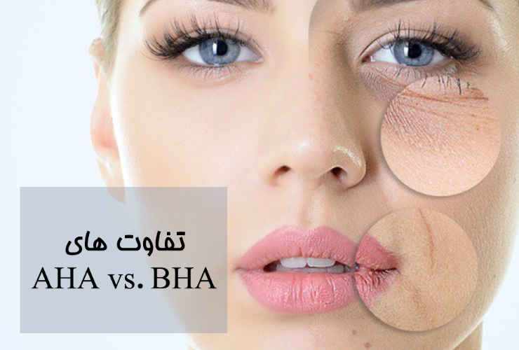 تفاوت AHA  و BHA
