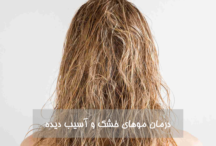 درمان موهای خشک